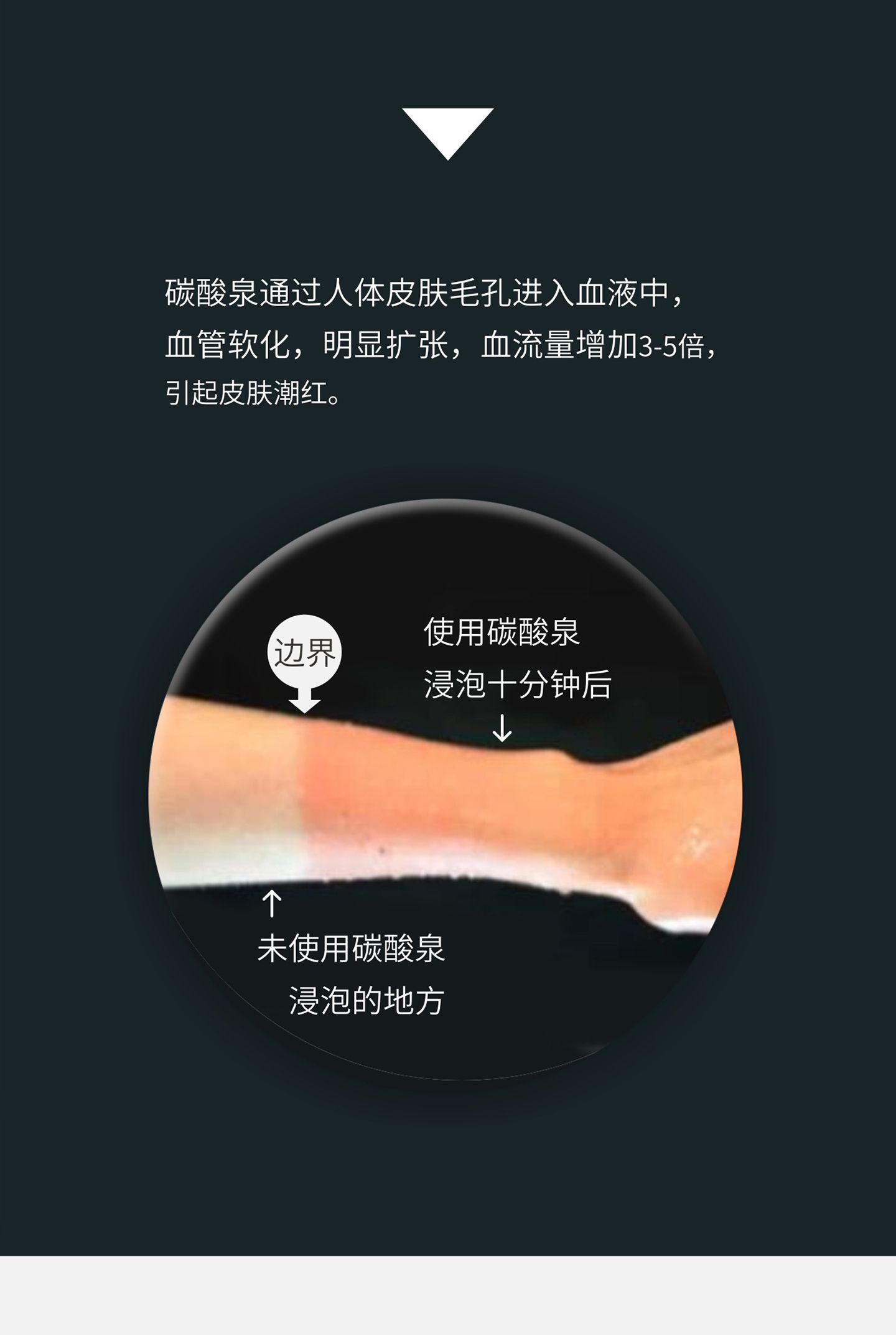 家用碳酸泉水赋能仪 产品详情图 3