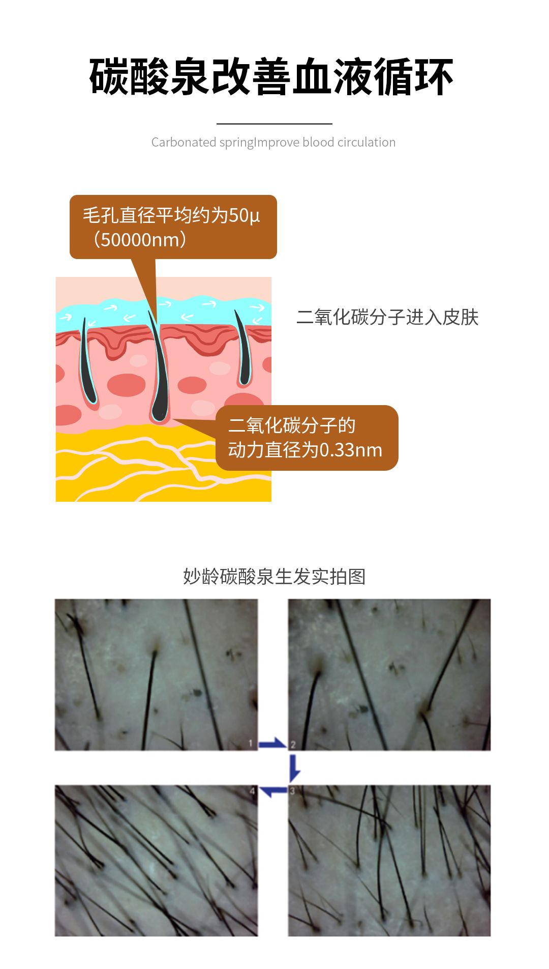 碳酸泉水赋能仪 头皮护理机 产品详情图 5