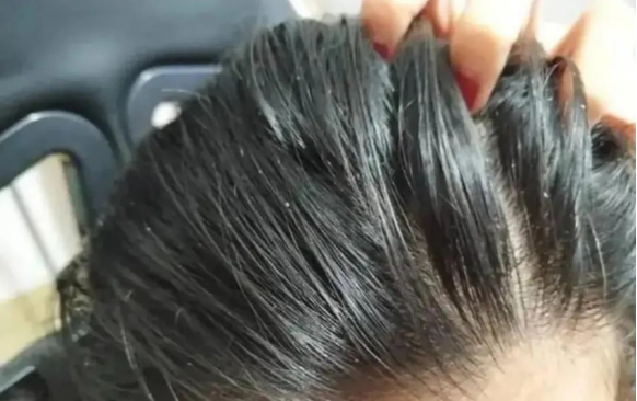 为什么头发总是很油腻？3招教你减少出油！