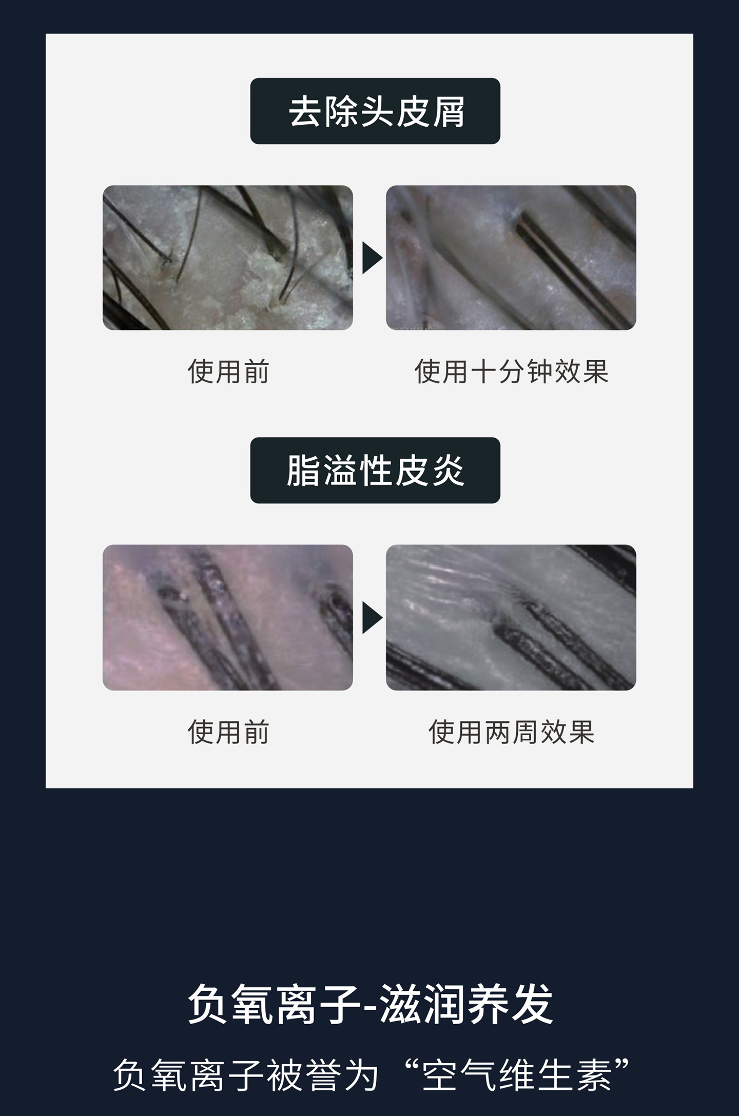 洗头机_07.jpg